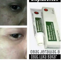 Harga Obat Luka Bakar Bioplacenton Katalog.or.id Harga Obat Luka Bakar Bioplacenton Katalog.or.id