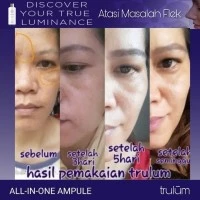 Pemutih Wajah Lengkap // 5ml
