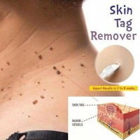 Marks Auto Mart >> Jual Skin Tag Di Kota Surabaya Harga Terbaru 2020 Tokopedia Marks Auto Mart >> Jual Skin Tag Di Kota Surabaya Harga Terbaru 2020 Tokopedia
