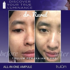 Kosmetik Herbal Alami Menghilangkan Flek Hitam Pada Wajah Tokopedia