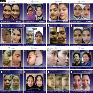 Kosmetik Herbal Alami Menghilangkan Flek Hitam Pada Wajah Tokopedia