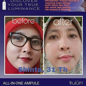 Kosmetik Herbal Alami Menghilangkan Flek Hitam Pada Wajah Tokopedia
