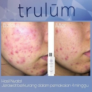 Kosmetik Herbal Alami Menghilangkan Flek Hitam Pada Wajah Tokopedia