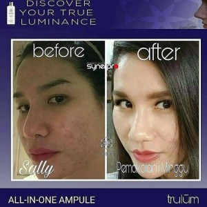 Kosmetik Herbal Alami Menghilangkan Flek Hitam Pada Wajah Tokopedia