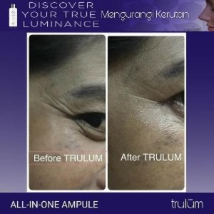 Terlaris Kosmetik Anti Aging Terbaik Tr L M Serum Terbaik Bukalapak Tokopedia
