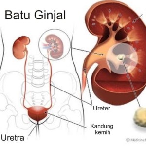 88+ Gambar Saluran Ginjal Kekinian 88+ Gambar Saluran Ginjal Kekinian