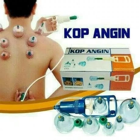 Foto Produk Alat Bekam Kop Angin Isi 6 Tabung dari KADOUNIKSHOP