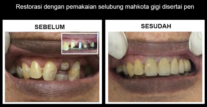 tokopedia-product-detail-0