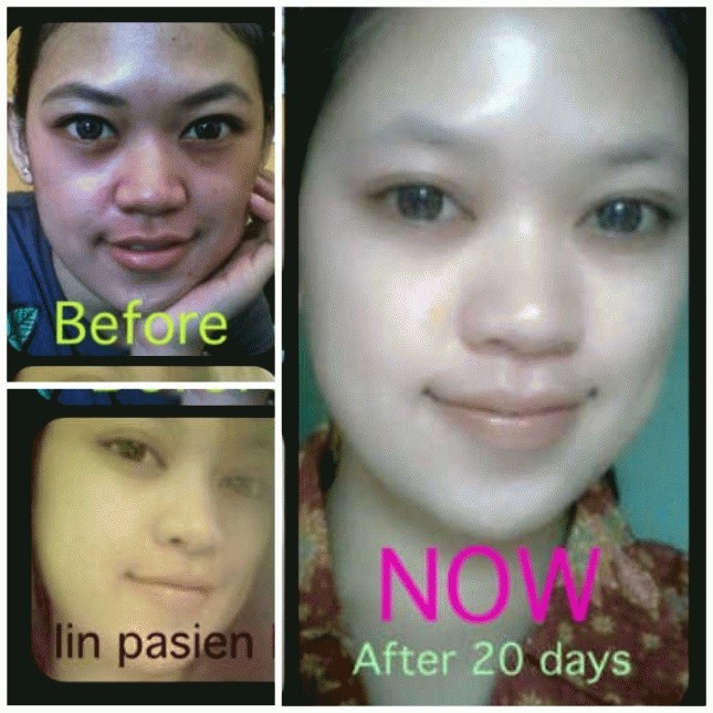 jual fresh marine collagen 100 murni collagen best seller jual fresh marine collagen 100 murni collagen best seller