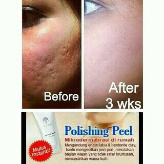 nu skin polishing peel nu skin polishing peel