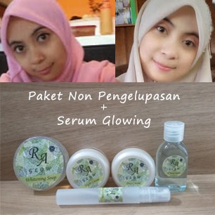 jual ra glow paket non pengelupasan serum glowing jual ra glow paket non pengelupasan serum glowing