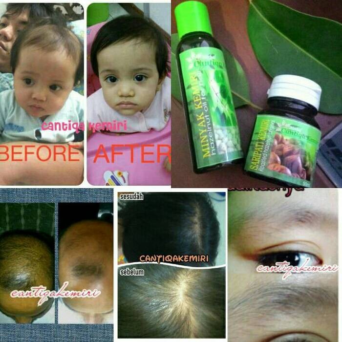 jual paket penyubur rambut alami cantiqa kemiri (minyak kemiri + Minyak Dan Saripati Cantiqa Kemiri jual paket penyubur rambut alami cantiqa kemiri (minyak kemiri + Minyak Dan Saripati Cantiqa Kemiri
