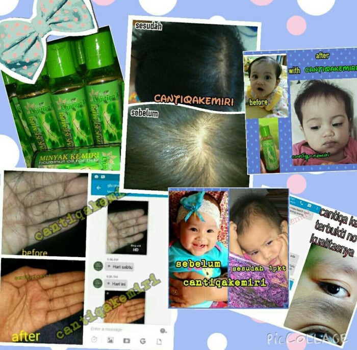 jual paket penyubur rambut alami cantiqa kemiri (minyak kemiri + Minyak Dan Saripati Cantiqa Kemiri jual paket penyubur rambut alami cantiqa kemiri (minyak kemiri + Minyak Dan Saripati Cantiqa Kemiri