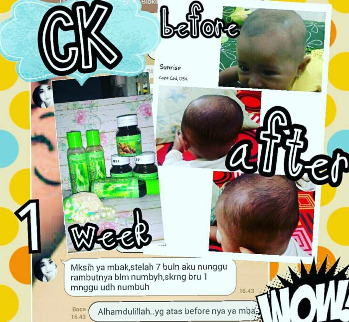 jual penyubur rambut herbal alami cantiqa kemiri (minyak kemiri + Minyak Dan Saripati Cantiqa Kemiri jual penyubur rambut herbal alami cantiqa kemiri (minyak kemiri + Minyak Dan Saripati Cantiqa Kemiri