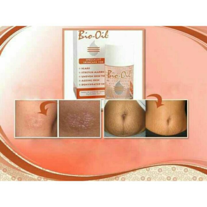 Info Bio Oil Travelbon.com Info Bio Oil Travelbon.com