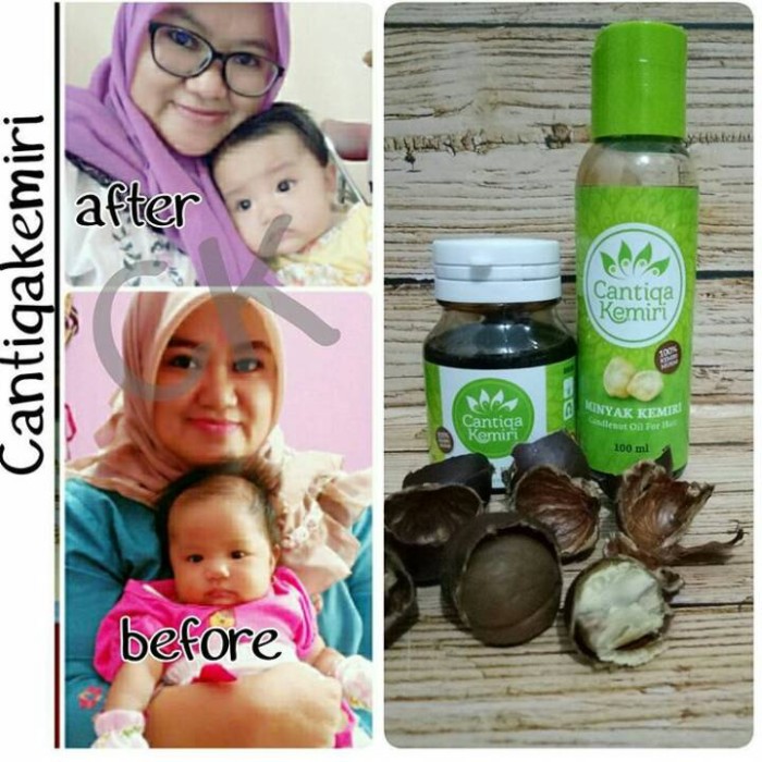 jual minyak+saripati cantiqa kemiri asli penumbuh rambut bayi/dewasa Minyak Dan Saripati Cantiqa Kemiri jual minyak+saripati cantiqa kemiri asli penumbuh rambut bayi/dewasa Minyak Dan Saripati Cantiqa Kemiri