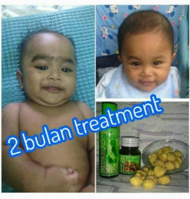 jual minyak+saripati cantiqa kemiri asli penumbuh rambut bayi/dewasa Minyak Dan Saripati Cantiqa Kemiri jual minyak+saripati cantiqa kemiri asli penumbuh rambut bayi/dewasa Minyak Dan Saripati Cantiqa Kemiri