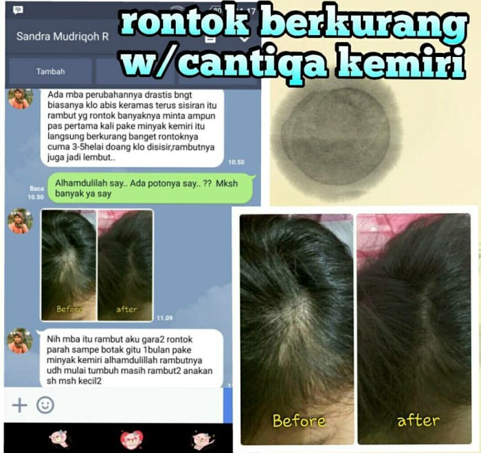 jual paket minyak & saripati cantiqa kemiri (aman utk bayi, bumil Minyak Dan Saripati Cantiqa Kemiri jual paket minyak & saripati cantiqa kemiri (aman utk bayi, bumil Minyak Dan Saripati Cantiqa Kemiri
