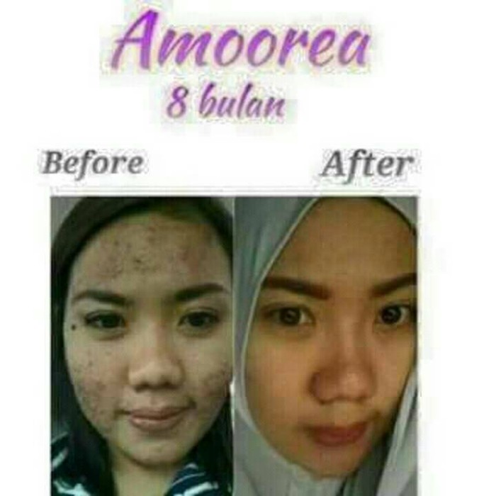 jual toner nu amoorea nu amoorea dermalabs toner jual toner nu amoorea nu amoorea dermalabs toner