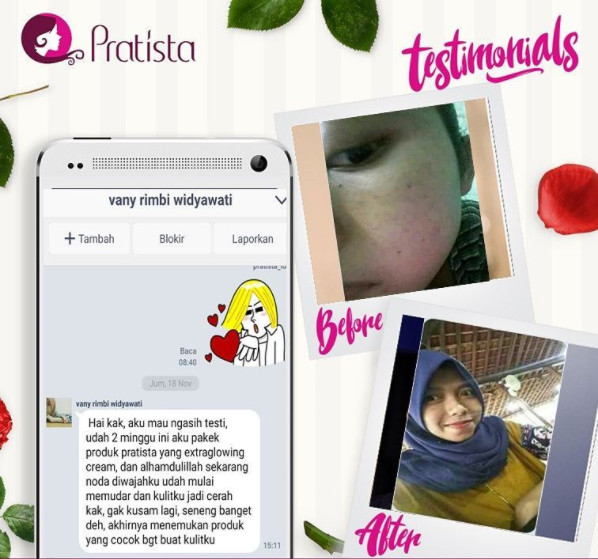 Extraglow Pratista : Obat Cream Penghilang Flek Hitam