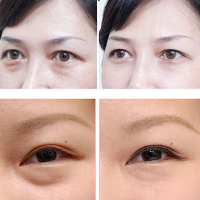 Promo Theraskin Eye Cream With Peptide -- Cream Perawatan Kantung Mata