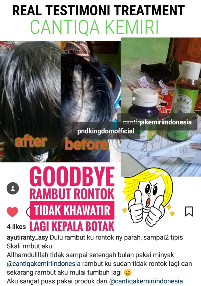 jual paket penyubur rambut alami cantiqa kemiri (minyak kemiri + Minyak Dan Saripati Cantiqa Kemiri jual paket penyubur rambut alami cantiqa kemiri (minyak kemiri + Minyak Dan Saripati Cantiqa Kemiri