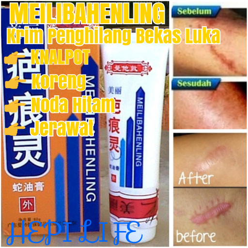 Harga Meilibahenling Penghilang Bekas Noda Travelbon.com Harga Meilibahenling Penghilang Bekas Noda Travelbon.com