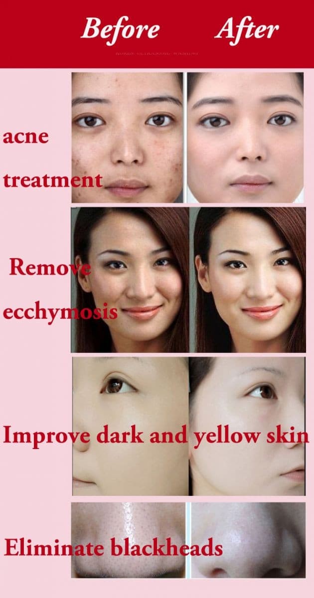 Pobling Brush Pembersih Muka Elektrik Face Brush Electric
