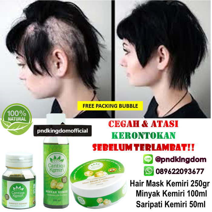 jual best seller : pahe trio cantiqa kemiri (anti rontok, tebal Minyak Dan Saripati Cantiqa Kemiri jual best seller : pahe trio cantiqa kemiri (anti rontok, tebal Minyak Dan Saripati Cantiqa Kemiri