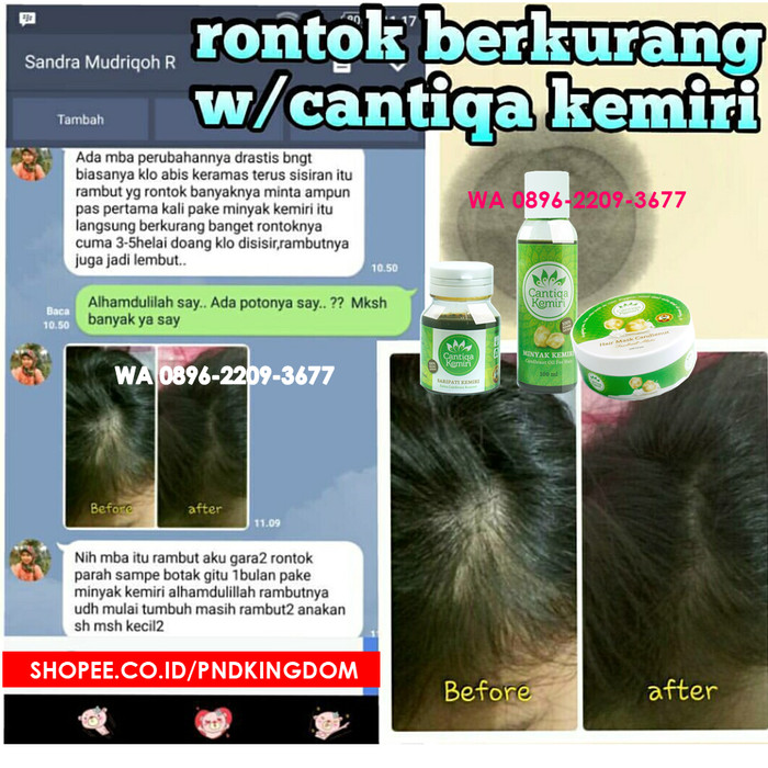 jual paket penyubur rambut alami cantiqa kemiri (minyak kemiri + Minyak Dan Saripati Cantiqa Kemiri jual paket penyubur rambut alami cantiqa kemiri (minyak kemiri + Minyak Dan Saripati Cantiqa Kemiri