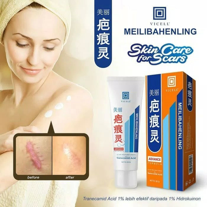 Info Meilibahenling Penghilang Bekas Noda Travelbon.com Info Meilibahenling Penghilang Bekas Noda Travelbon.com