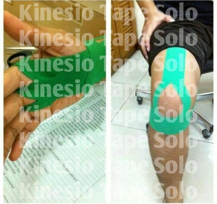 Sale Kinesio Tape / Tapping Kinesiology Tape 5cm x 5m TERMURAH