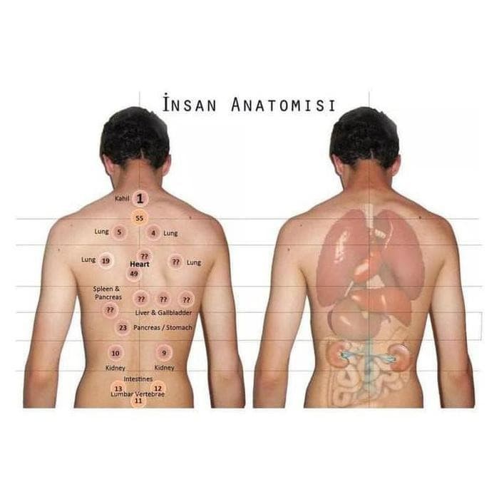 Jual Terlaris Alat Kesehatan Terapi Bekam 12 Kop Cup Jos Jakarta Pusat Evostore888 Tokopedia