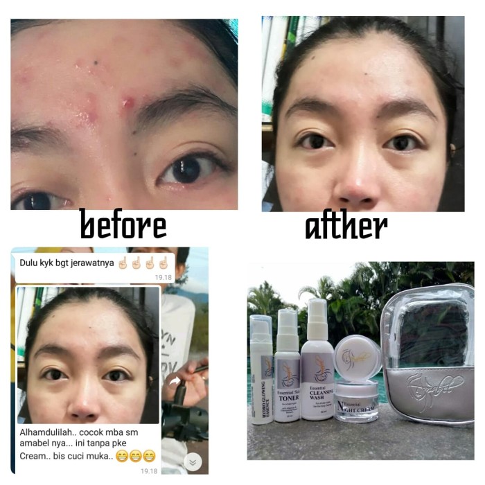 Busui Pemutih Cream Busui Pemutih Cream