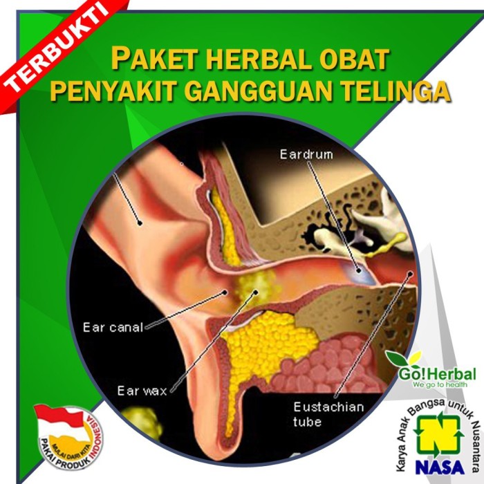 Unduh 78+ Gambar Gangguan Telinga  Gratis HD