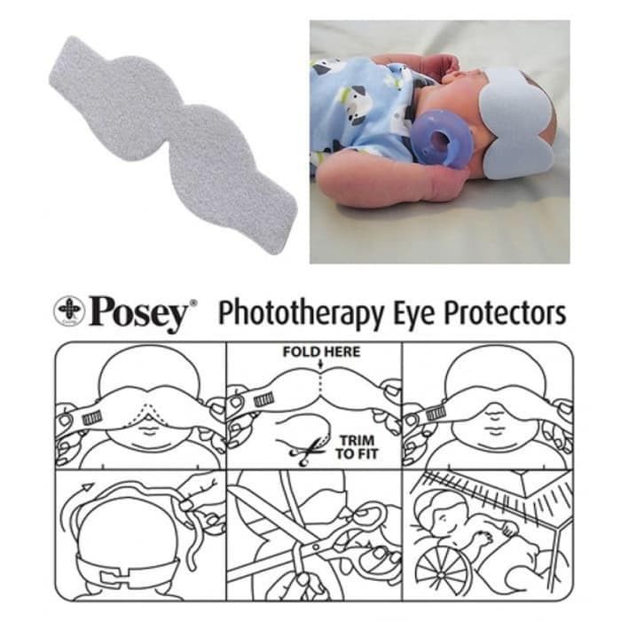Posey Phototherapy Eye Protectors Newborn tillescenter Personal