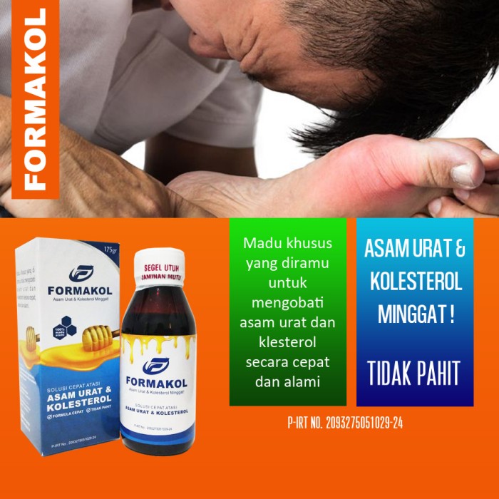 Mengobati Lutut Bengkak Karena Asam Urat