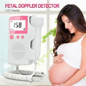 baby doppler in store