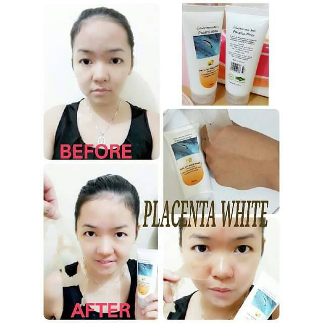 masker placenta