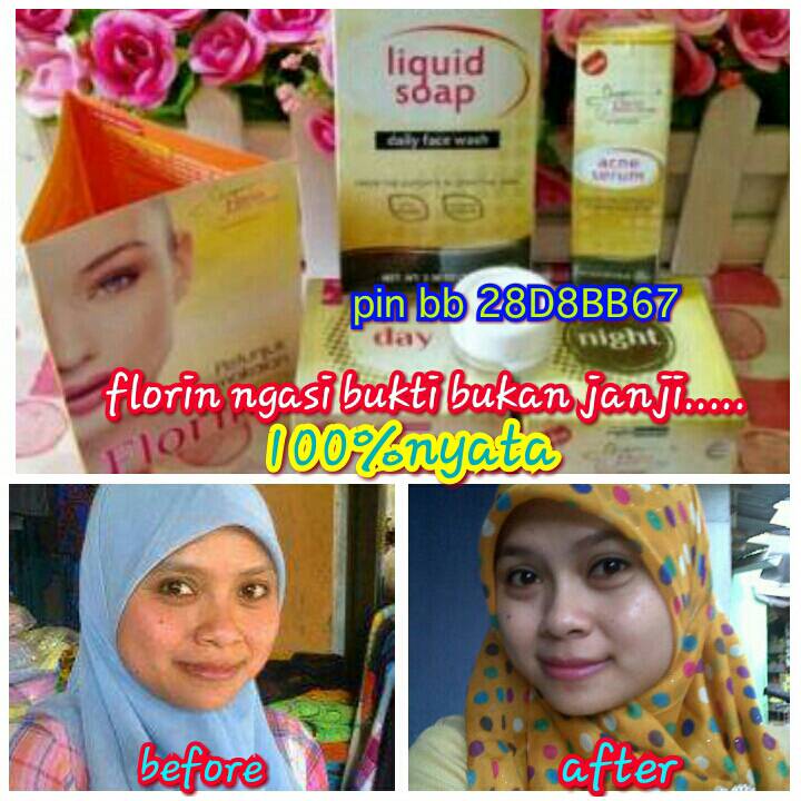 jual florin skin care violet skincare jual florin skin care violet skincare