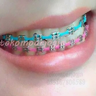 jual behel gigi lepas pasang atas bawah motif chain jual behel gigi lepas pasang atas bawah motif chain