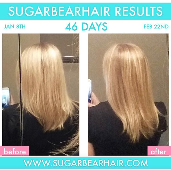 jual sugar hair vitamin moabeauty jual sugar hair vitamin moabeauty