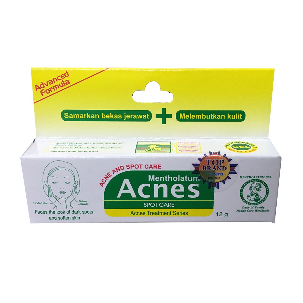 acnes penghilang jerawat acnes penghilang jerawat